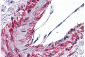 Human Vessel: Formalin-Fixed, Paraffin-Embedded (FFPE) (TBXA2R antibody  (AA 1-15))
