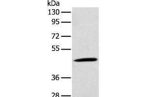 Western blot analysis of Rat kidney tissue using CCBL1 Polyclonal Antibody at dilution of 1:300 (CCBL1 antibody)