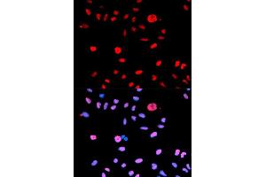 Immunofluorescence analysis of U2OS cells using Phospho-MDM2-S166 antibody (ABIN5969918). (MDM2 antibody  (pSer166))