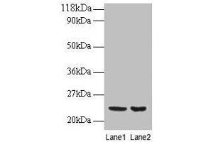 Western blot All lanes: PRDX1 antibody at 2 μg/mL Lane 1: EC109 whole cell lysate Lane 2: 293T whole cell lysate Secondary Goat polyclonal to rabbit IgG at 1/15000 dilution Predicted band size: 23 kDa Observed band size: 23 kDa (Peroxiredoxin 1 antibody  (AA 1-199))
