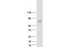 Western Blotting (WB) image for Sialic Acid Binding Ig-Like Lectin 14 (SIGLEC14) protein (Myc-DYKDDDDK Tag) (ABIN2732024)