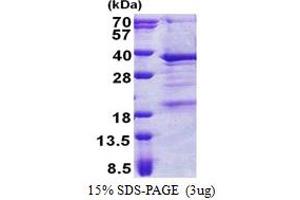 SDS-PAGE (SDS) image for THAP Domain Containing, Apoptosis Associated Protein 3 (THAP3) (AA 1-239) protein (His tag) (ABIN5778815) (THAP3 Protein (AA 1-239) (His tag))