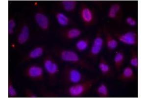 Image no. 1 for anti-Myocyte Enhancer Factor 2A (MEF2A) (pThr312) antibody (ABIN196683) (MEF2A antibody  (pThr312))