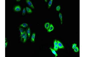 Immunofluorescent analysis of HepG2 cells using ABIN7170263 at dilution of 1:100 and Alexa Fluor 488-congugated AffiniPure Goat Anti-Rabbit IgG(H+L) (SLC46A3 antibody  (AA 26-73))