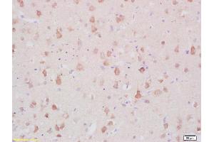 Formalin-fixed and paraffin embedded rat brain labeled with Anti-MARCKS Polyclonal Antibody, Unconjugated (ABIN681538) at 1:200 followed by conjugation to the secondary antibody and DAB staining (MARCKS antibody  (AA 31-120))