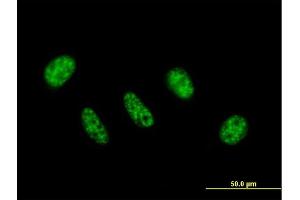 Immunofluorescence of purified MaxPab antibody to ZC3H11A on HeLa cell. (ZC3H11A antibody  (AA 1-810))