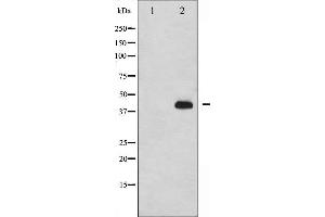 Western blot analysis of p47 phox phosphorylation expression in nocodazole treated HeLa whole cell lysates,The lane on the left is treated with the antigen-specific peptide. (NCF1 antibody  (pSer359))