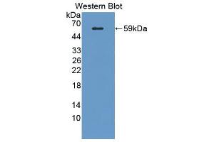 Western blot analysis of the recombinant protein. (SIGLEC8 antibody  (AA 70-336))