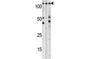 Western Blotting (WB) image for anti-Chromosome Segregation 1-Like (CSE1L) antibody (ABIN3000895) (CSE1L antibody)