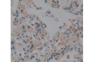 Used in DAB staining on fromalin fixed paraffin- embedded lung tissue (DICER1 antibody  (AA 6-290))