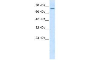 WB Suggested Anti-KCNN3  Antibody Titration: 0. (KCNN3 antibody  (C-Term))