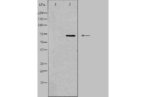 SCNN1D antibody  (C-Term)
