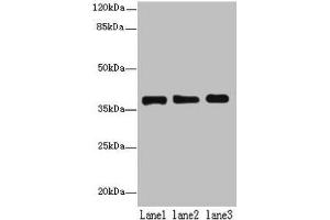 Western blot All lanes: MRPL44 antibody at 6 μg/mL Lane 1: Hela whole cell lysate Lane 2: Jurkat whole cell lysate Lane 3: K562 whole cell lysate Secondary Goat polyclonal to rabbit IgG at 1/10000 dilution Predicted band size: 38 kDa Observed band size: 38 kDa (MRPL44 antibody  (AA 31-332))
