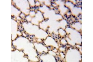 Used in DAB staining on fromalin fixed paraffin-embedded Lung tissue (IL-1 beta antibody  (AA 117-269))