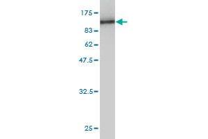 Western Blot detection against Immunogen (90. (COL5A1 antibody  (AA 1-591))