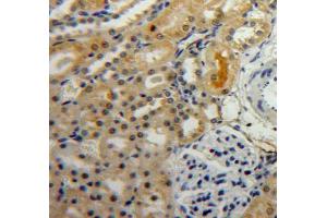 Immunohistochemistry (Paraffin-embedded Sections) (IHC (p)) image for anti-Hypoxia Inducible Factor 1, alpha Subunit (Basic Helix-Loop-Helix Transcription Factor) (HIF1A) (AA 216-337) antibody (ABIN2934002)