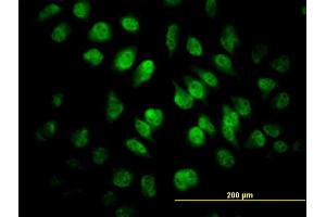 Immunofluorescence of monoclonal antibody to SAFB on HeLa cell. (SAFB antibody  (AA 111-200))
