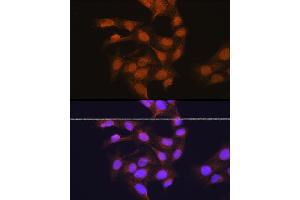 Immunofluorescence analysis of U-2 OS cells using 67 kDa Laminin Receptor Rabbit pAb (ABIN6128199, ABIN6147247, ABIN6147248 and ABIN6224857) at dilution of 1:100 (40x lens). (RPSA/Laminin Receptor antibody  (AA 1-295))