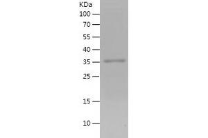 Western Blotting (WB) image for Family with Sequence Similarity 129, Member A (FAM129A) (AA 189-413) protein (His tag) (ABIN7122875) (Niban Protein (AA 189-413) (His tag))