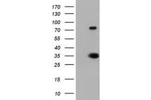 HEK293T cells were transfected with the pCMV6-ENTRY control (Left lane) or pCMV6-ENTRY ERCC1 (Right lane) cDNA for 48 hrs and lysed. (ERCC1 antibody)