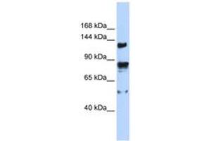 Image no. 1 for anti-Transient Receptor Potential Cation Channel, Subfamily M, Member 4 (TRPM4) (AA 359-408) antibody (ABIN6742557)
