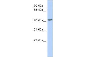 WB Suggested Anti-ST3GAL4 Antibody Titration:  0.