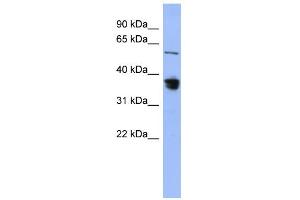 WB Suggested Anti-RAD23B Antibody Titration: 0.