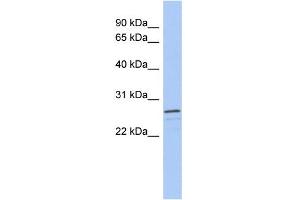 WB Suggested Anti-VSTM2A Antibody Titration: 0. (VSTM2A antibody  (Middle Region))