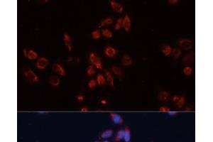 Immunofluorescence analysis of HeLa cells using GPC4 Polyclonal Antibody at dilution of 1:100. (GPC4 antibody)