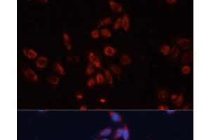 Immunofluorescence analysis of HeLa cells using GPC4 Polyclonal Antibody at dilution of 1:100. (GPC4 antibody)
