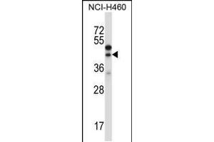 Western blot analysis in NCI-H460 cell line lysates (35ug/lane). (CTGF antibody  (AA 166-193))
