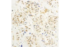 Immunohistochemistry (IHC) image for anti-V-Myb Myeloblastosis Viral Oncogene Homolog (Avian) (MYB) (AA 175-225) antibody (ABIN7454502)