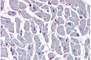 Anti-CYSLTR2 / CYSLT2 antibody  ABIN1048491 IHC staining of human heart.