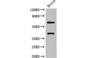 Western Blot Positive WB detected in: Mouse brain tissue All lanes: LRRTM4 antibody at 3 μg/mL Secondary Goat polyclonal to rabbit IgG at 1/50000 dilution Predicted band size: 68, 60 kDa Observed band size: 68, 40 kDa (LRRTM4 antibody  (AA 259-419))