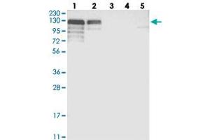 Western blot analysis of Lane 1: RT-4, Lane 2: U-251 MG, Lane 3: Human Plasma, Lane 4: Liver, Lane 5: Tonsil with NHSL1 polyclonal antibody  at 1:250-1:500 dilution. (NHSL1 antibody)