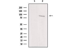 Western blot analysis of extracts from rat brain, using IKBKE Antibody. (IKKi/IKKe antibody  (C-Term))