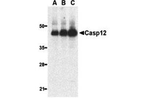Western Blotting (WB) image for anti-Caspase 12 (Gene/pseudogene) (CASP12) (Large Isoform) antibody (ABIN1031699) (Caspase 12 antibody  (Large Isoform))