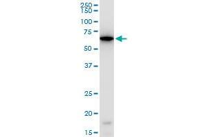 ERO1L polyclonal antibody (A01), Lot # FAK0060317QCS1. (ERO1L antibody  (AA 90-178))