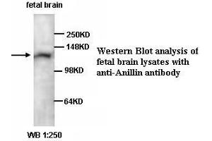 Image no. 1 for anti-Anillin, Actin Binding Protein (ANLN) antibody (ABIN1574694)
