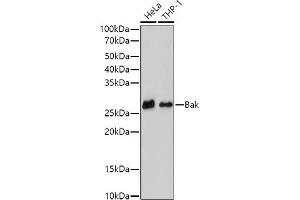 Western blot analysis of extracts of various cell lines, using (ABIN6129983, ABIN6135533, ABIN6135534 and ABIN7101358) at 1:500 dilution.