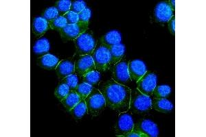 IF analysis of DSG2 using anti-DSG2 antibody (ABIN7600803). (Desmoglein 2 antibody  (AA 24-1020))