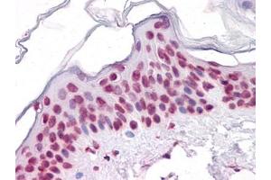 Immunohistochemistry (IHC) image for anti-Sirtuin 1 (SIRT1) (AA 456-555) antibody (ABIN614713) (SIRT1 antibody  (AA 456-555))