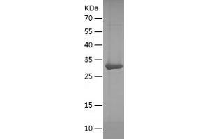Western Blotting (WB) image for Transducin-Like Enhancer of Split 1 (E(sp1) Homolog, Drosophila) (TLE1) (AA 1-251) protein (His tag) (ABIN7283371) (TLE1 Protein (AA 1-251) (His tag))