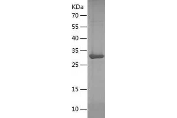 TLE1 Protein (AA 1-251) (His tag)