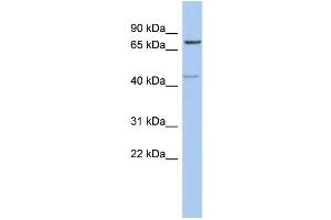 WB Suggested Anti-PEX5 Antibody Titration: 0. (PEX5 antibody  (Middle Region))