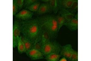 IF analysis of FAF1 using anti-FAF1 antibody (ABIN7602657) and anti-Beta Tubulin antibody (ABIN7602743).