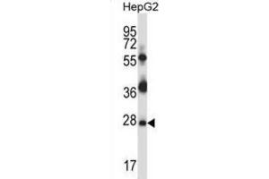 Western Blotting (WB) image for anti-TP53 Regulating Kinase (TP53RK) antibody (ABIN2997879) (TP53RK antibody)