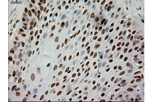 Immunohistochemical staining of paraffin-embedded kidney using anti-EpCAM (ABIN2452677) mouse monoclonal antibody. (EpCAM antibody  (AA 24-265))