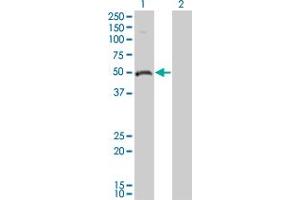 Western Blot analysis of ODC1 expression in transfected 293T cell line by ODC1 monoclonal antibody (M01), clone 2G5. (ODC1 antibody  (AA 1-461))
