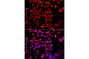 Immunofluorescence analysis of A549 cells using CFL2 antibody (ABIN5974961). (Cofilin 2 antibody)